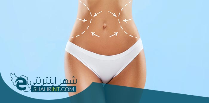 پیکرتراشی یا کانتورینگ